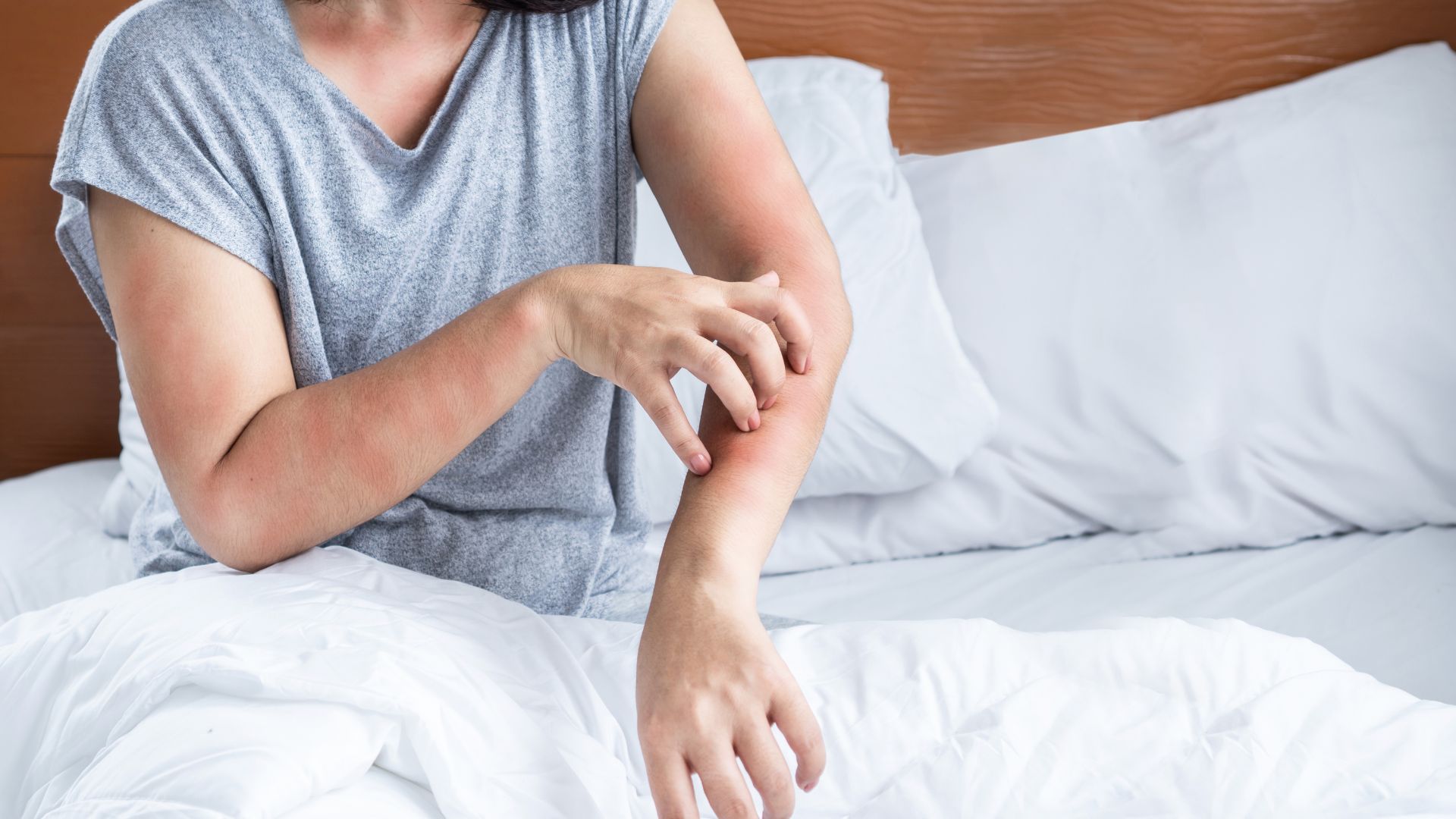Come Possiamo Riconoscere la Presenza degli Acari della Polvere e del Letto nella Nostra Casa?